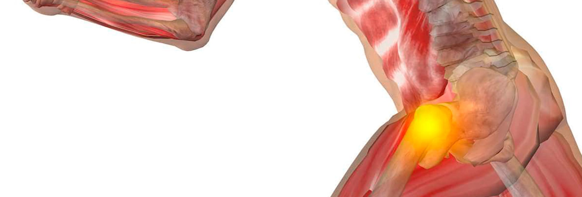 Lesão Labral: Sintomas e Tratamentos | Dr. Daniel Daniachi